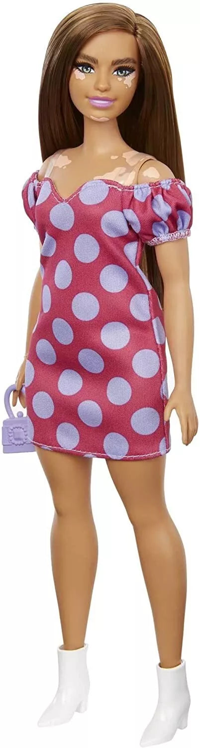 Barbie Fashionistas Doll Vitiligo Condition Polka Dot Dress