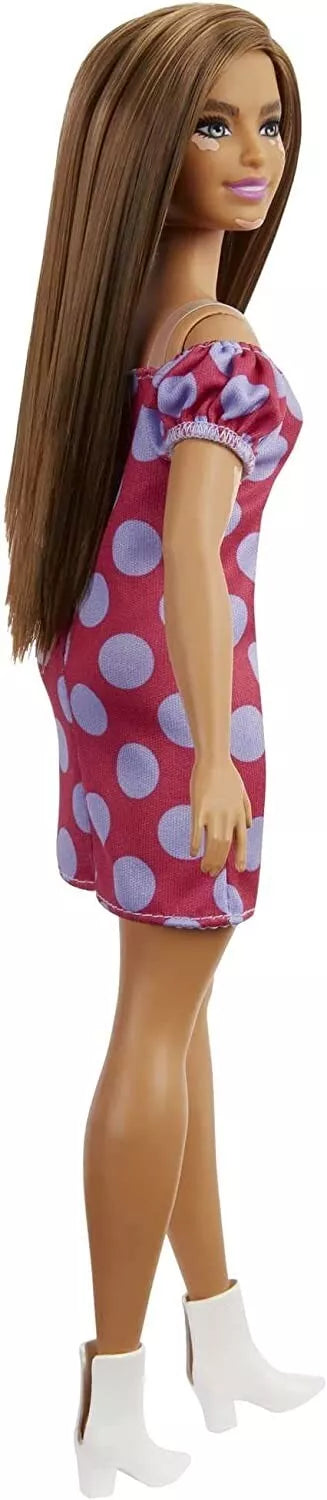 Barbie Fashionistas Doll Vitiligo Condition Polka Dot Dress