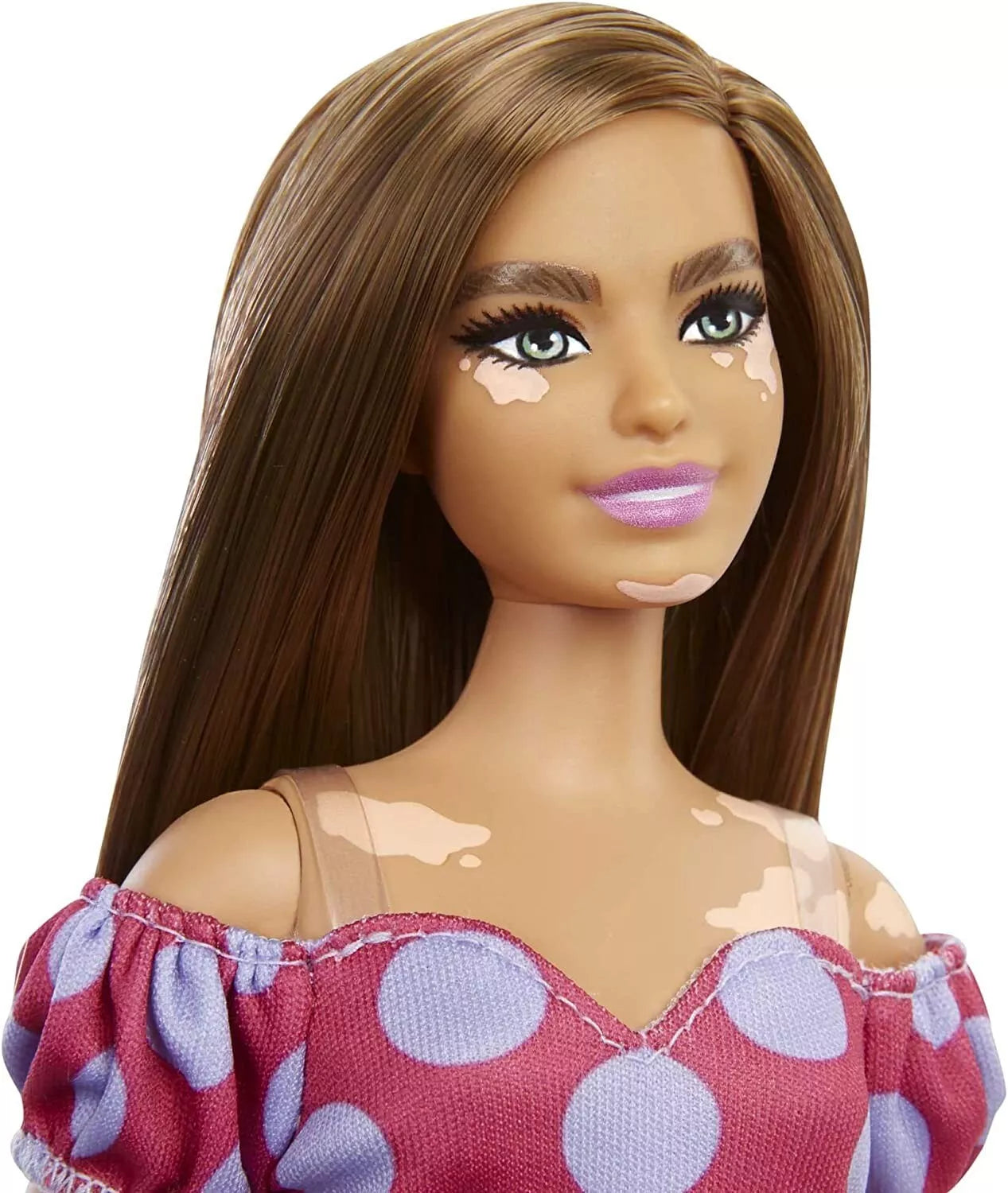 Barbie Fashionistas Doll Vitiligo Condition Polka Dot Dress